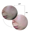 Niacinamide 10% + Zinc 1%